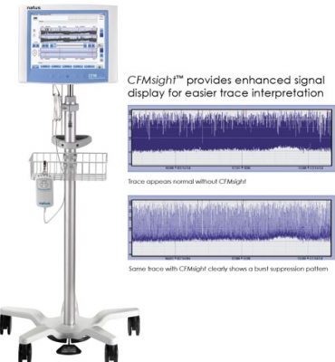 Cerebral Function Monitoring