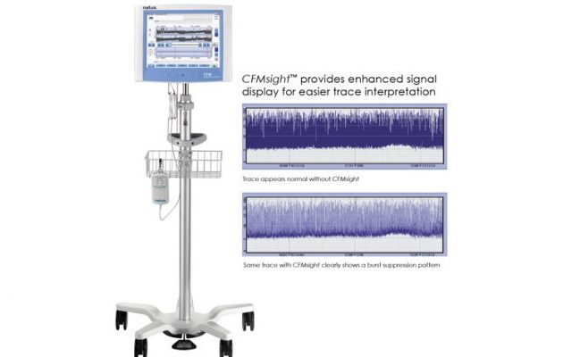 Cerebral Function Monitoring